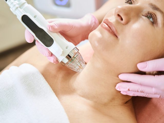 RF microneedling